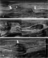 Fig. 10