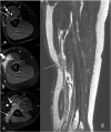 Fig. 11