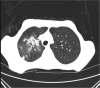 Figure 3