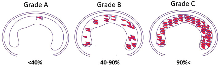 IWJ-12763-FIG-0002-c