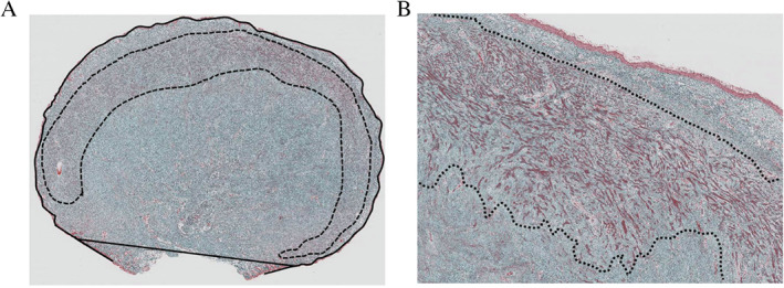 IWJ-12763-FIG-0001-c