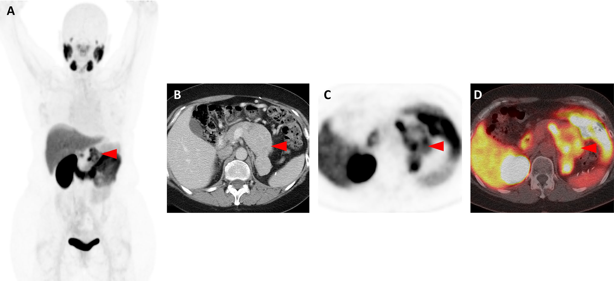 Fig. 1