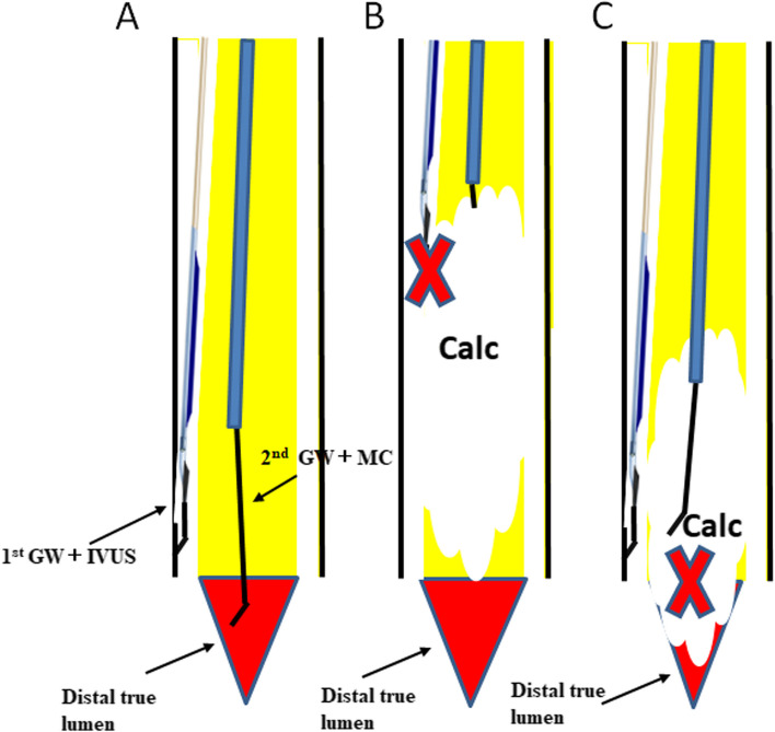 Fig. 4