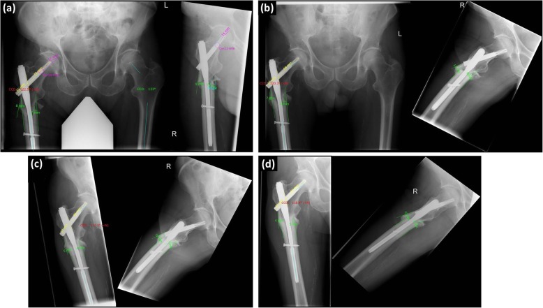 Fig. 1