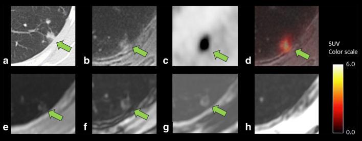 Fig. 5