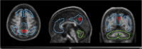 Fig. 9