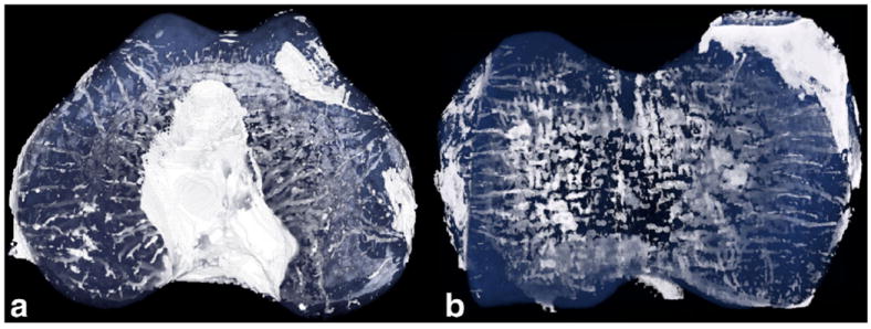 FIG. 5