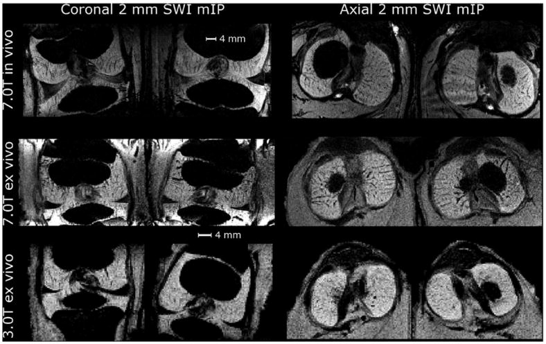 FIG. 6