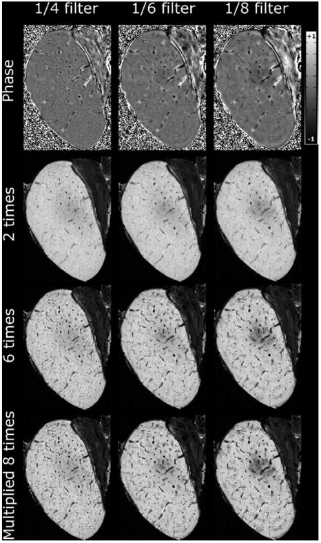 FIG. 1