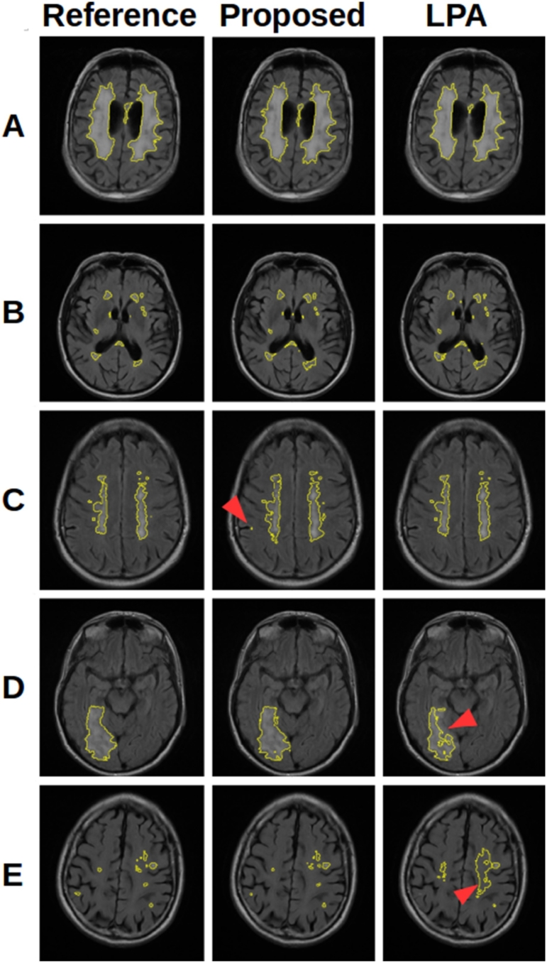 Fig. 13