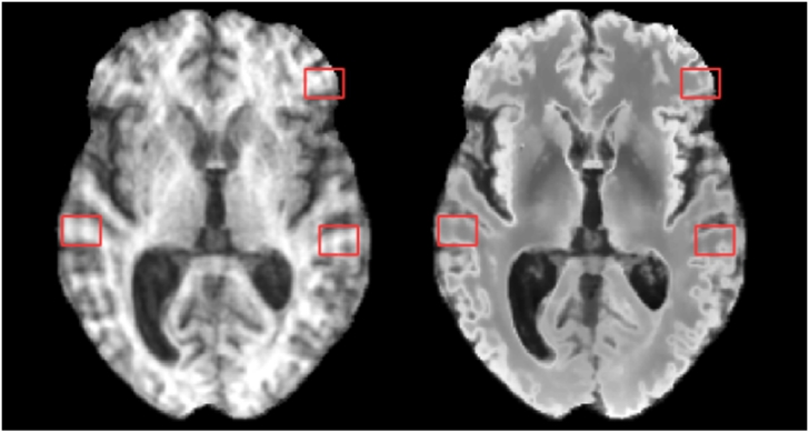 Fig. 11