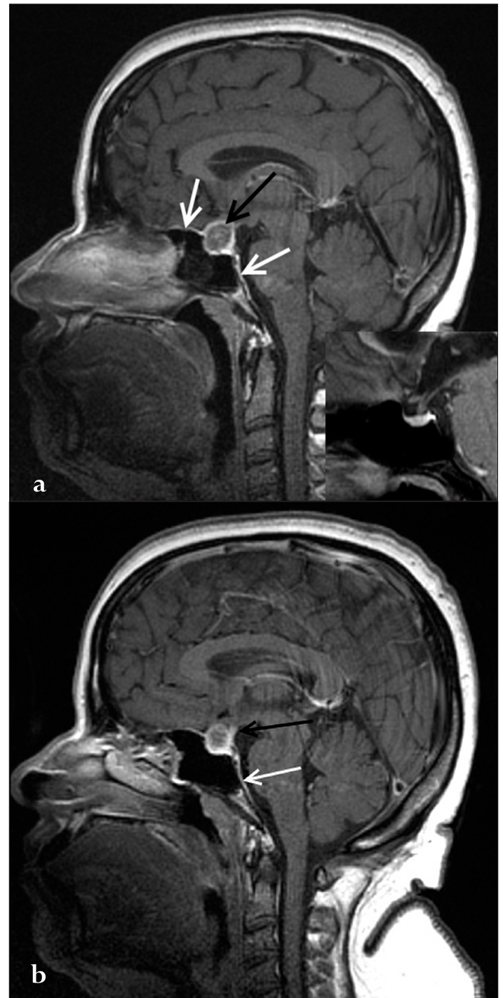 Figure 2a and b