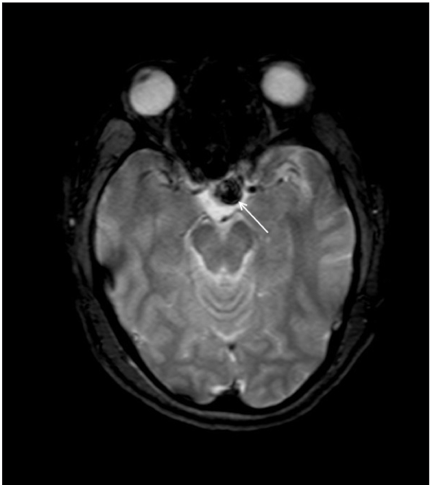 Figure 1c