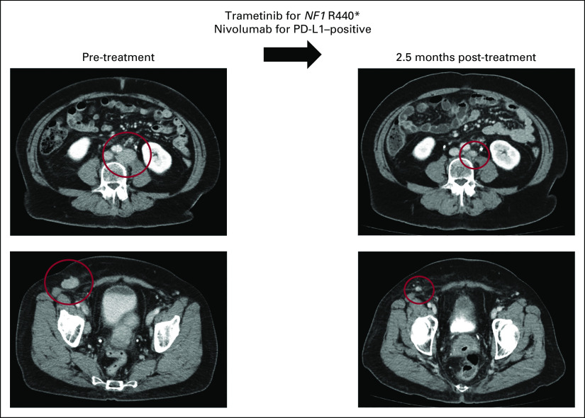 FIG 1.