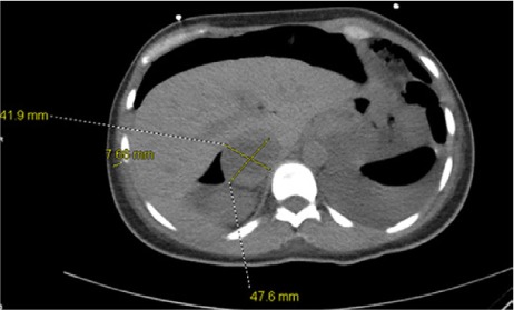 Fig. 2