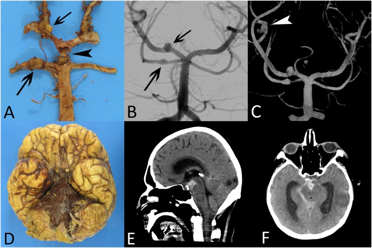 Fig 4