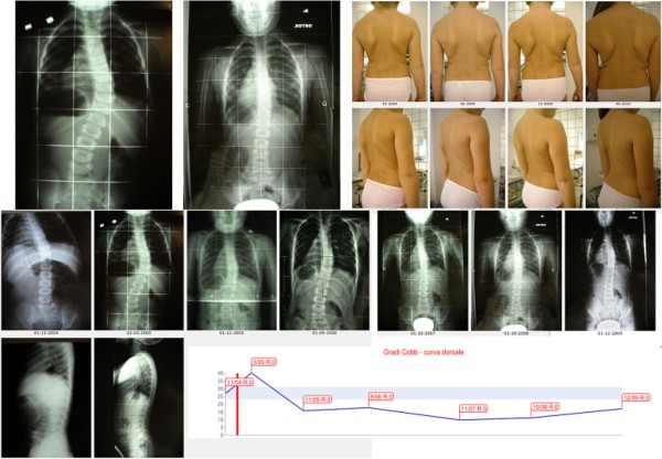 Figure 23