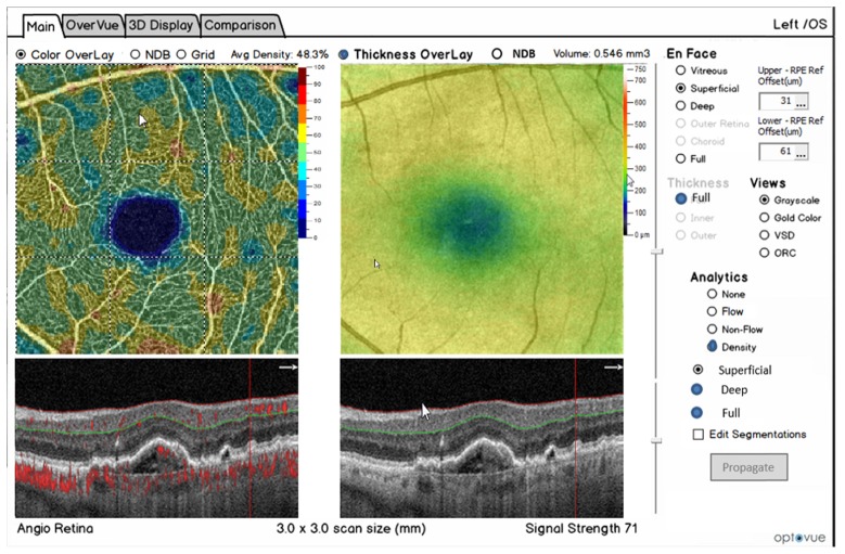 Fig. 12