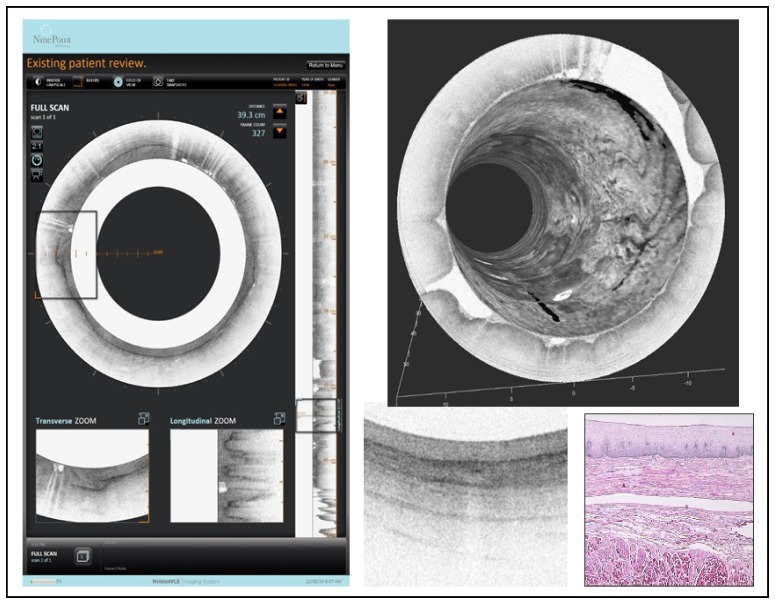 Fig. 19