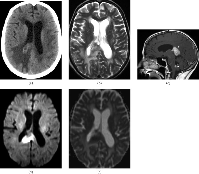 Figure 13