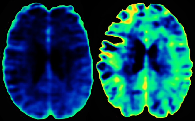 graphic file with name awv203fig1g.jpg