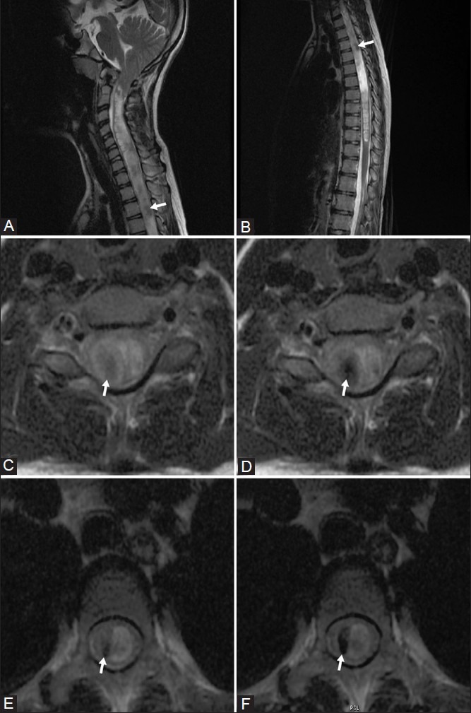 Figure 1 (A-F)