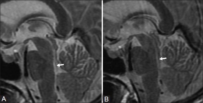 Figure 2 (A, B)