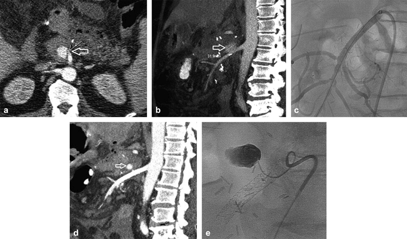 Fig. 9