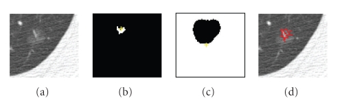 Figure 21