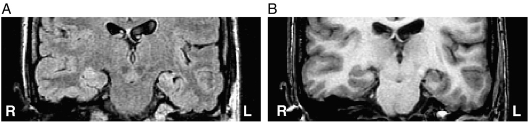 Fig. 11