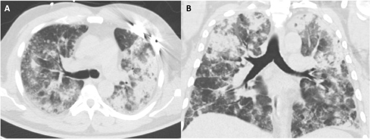 Fig 1