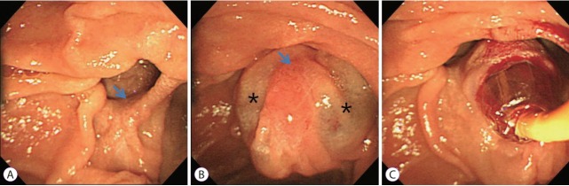 Fig. 2.