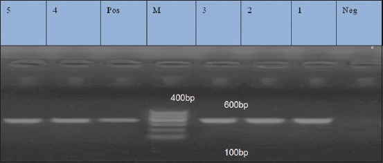 Figure-4