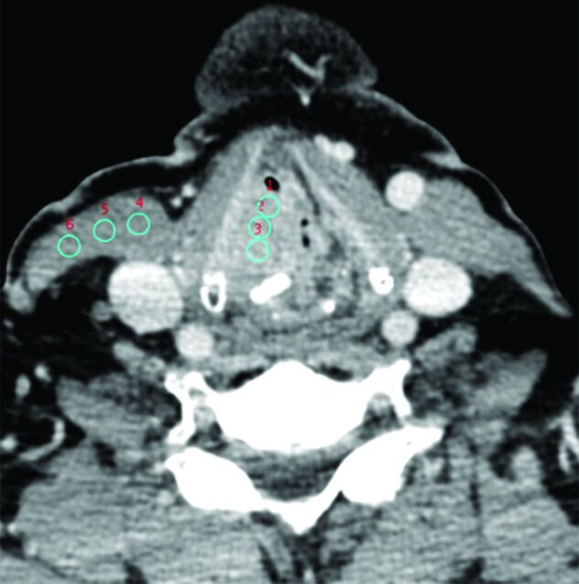 Fig 1.