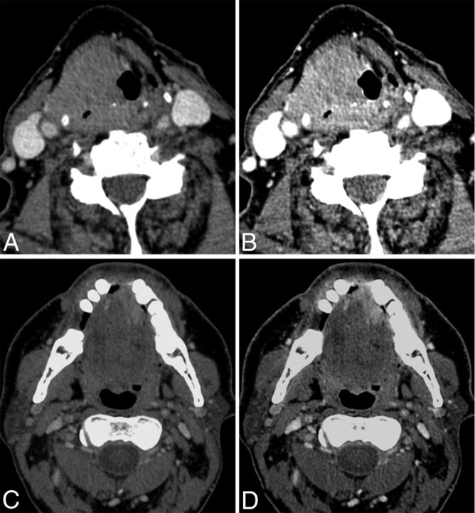 Fig 7.