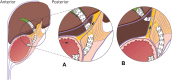 Figure 5
