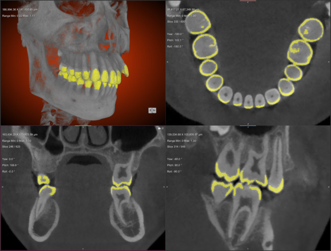 Fig. 2