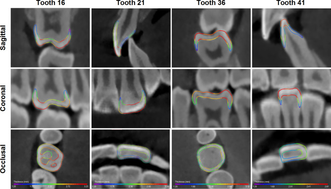 Fig. 4