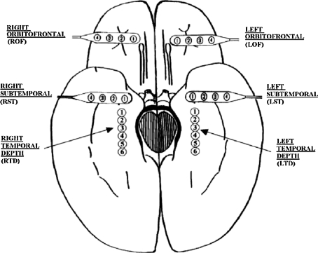 Fig. 1