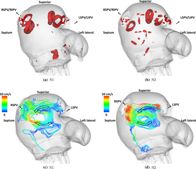 Fig. 12