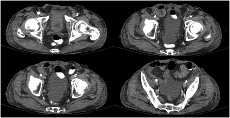 Fig. 4