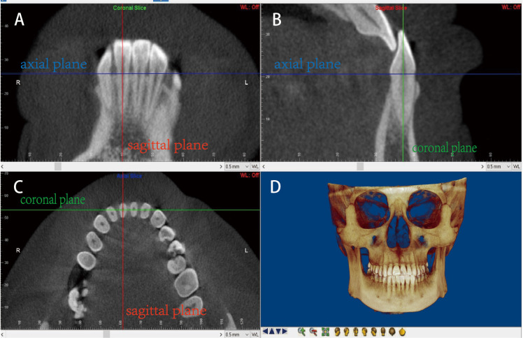 Fig 1