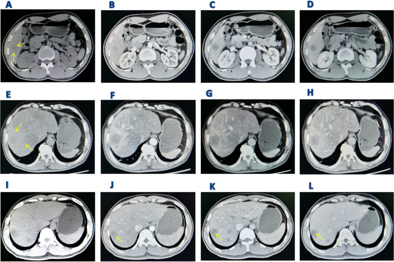 Fig. 3