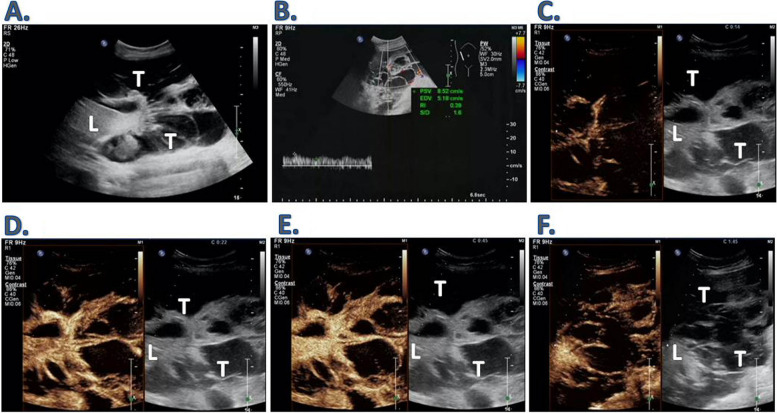 Fig. 2