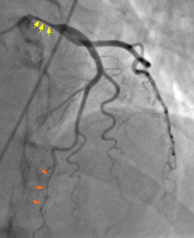 Figure 3