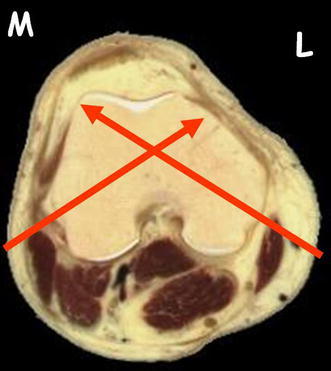 Fig. 6