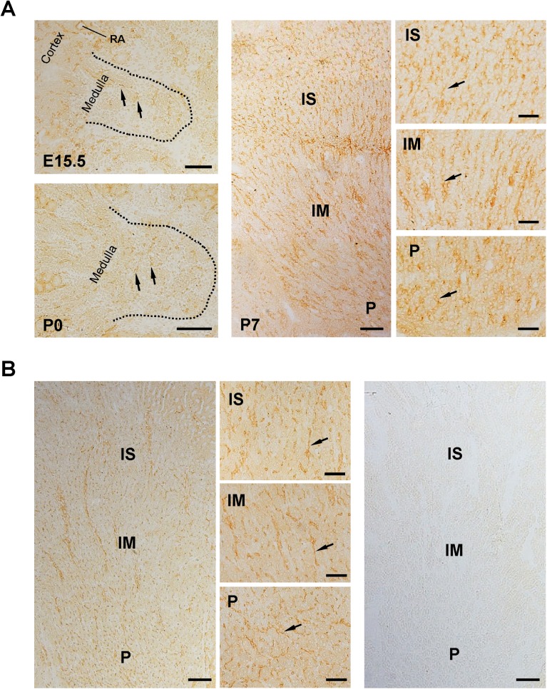 Fig 11