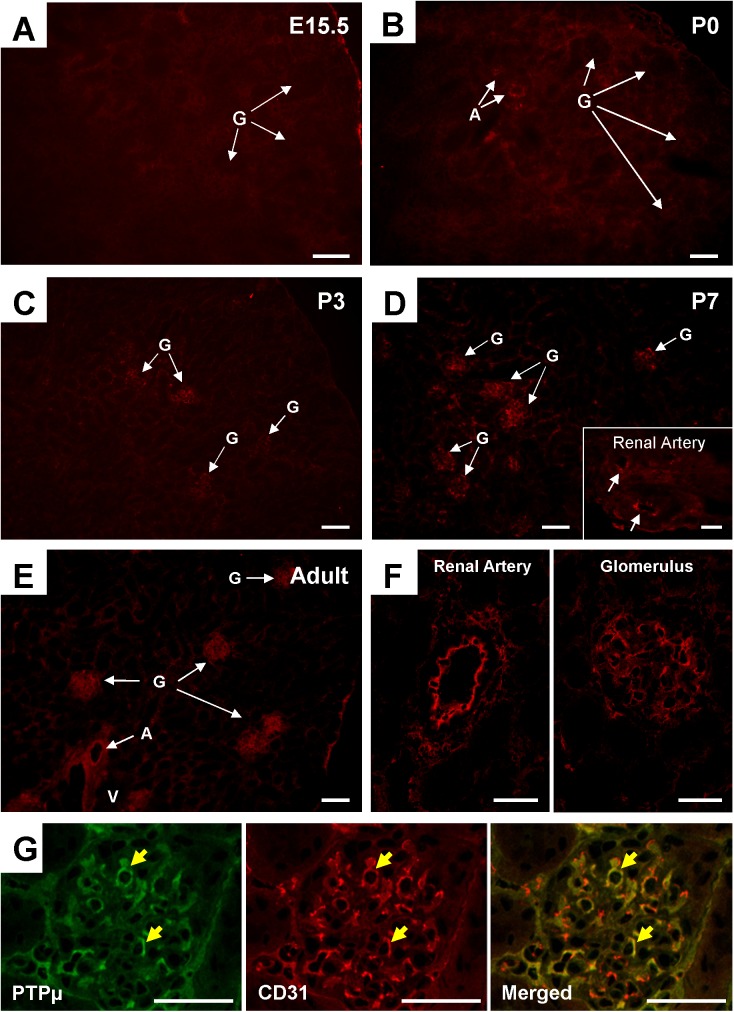 Fig 13