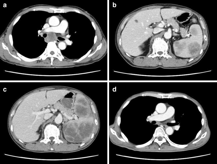 Fig. 1