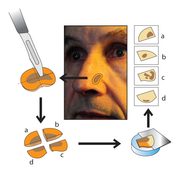 Figure 14